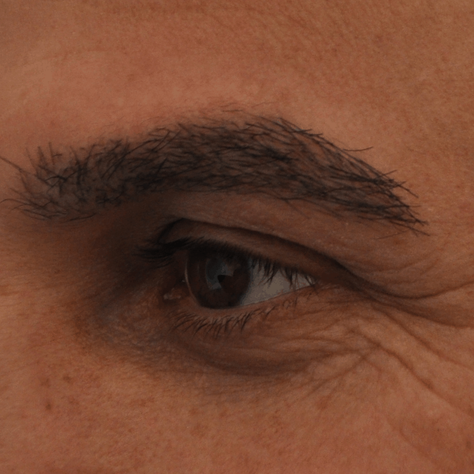After-Eyebrow-2